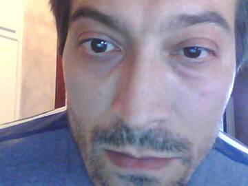 Public Photo of brachiale